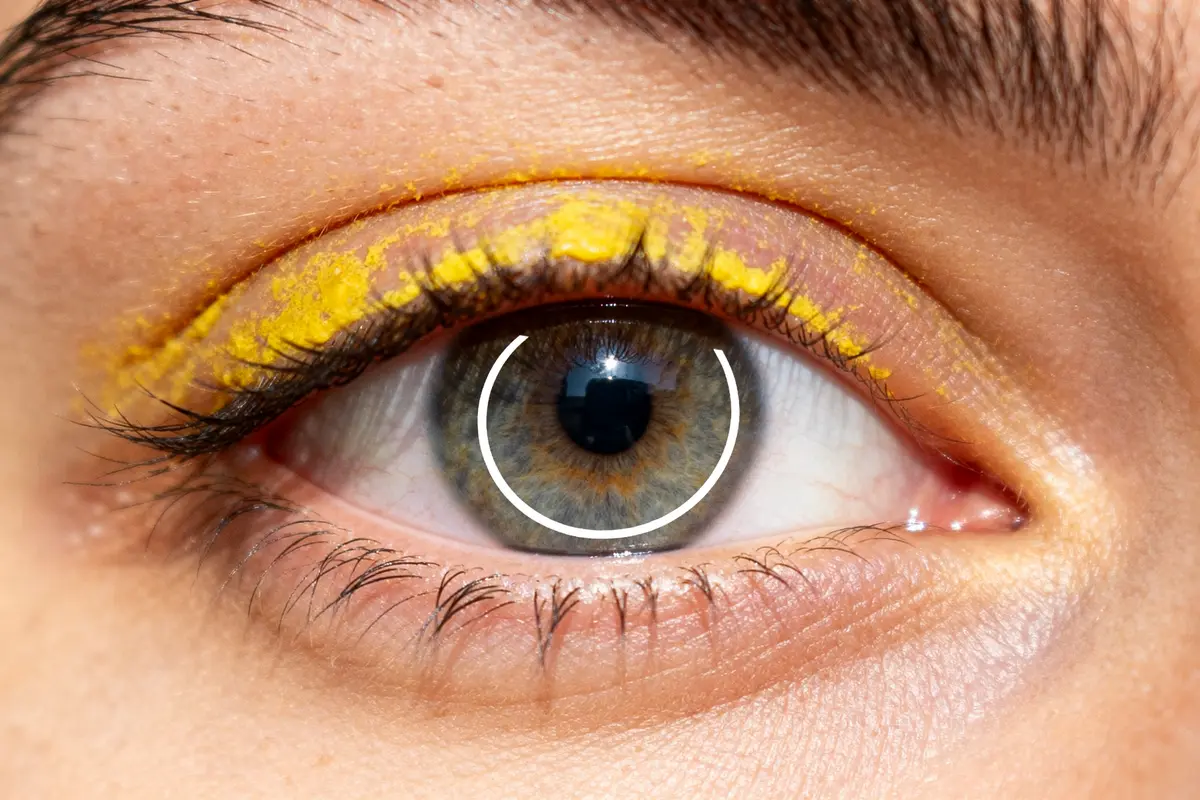 Cholestérol et symptômes aux yeux : 5 signes à surveiller